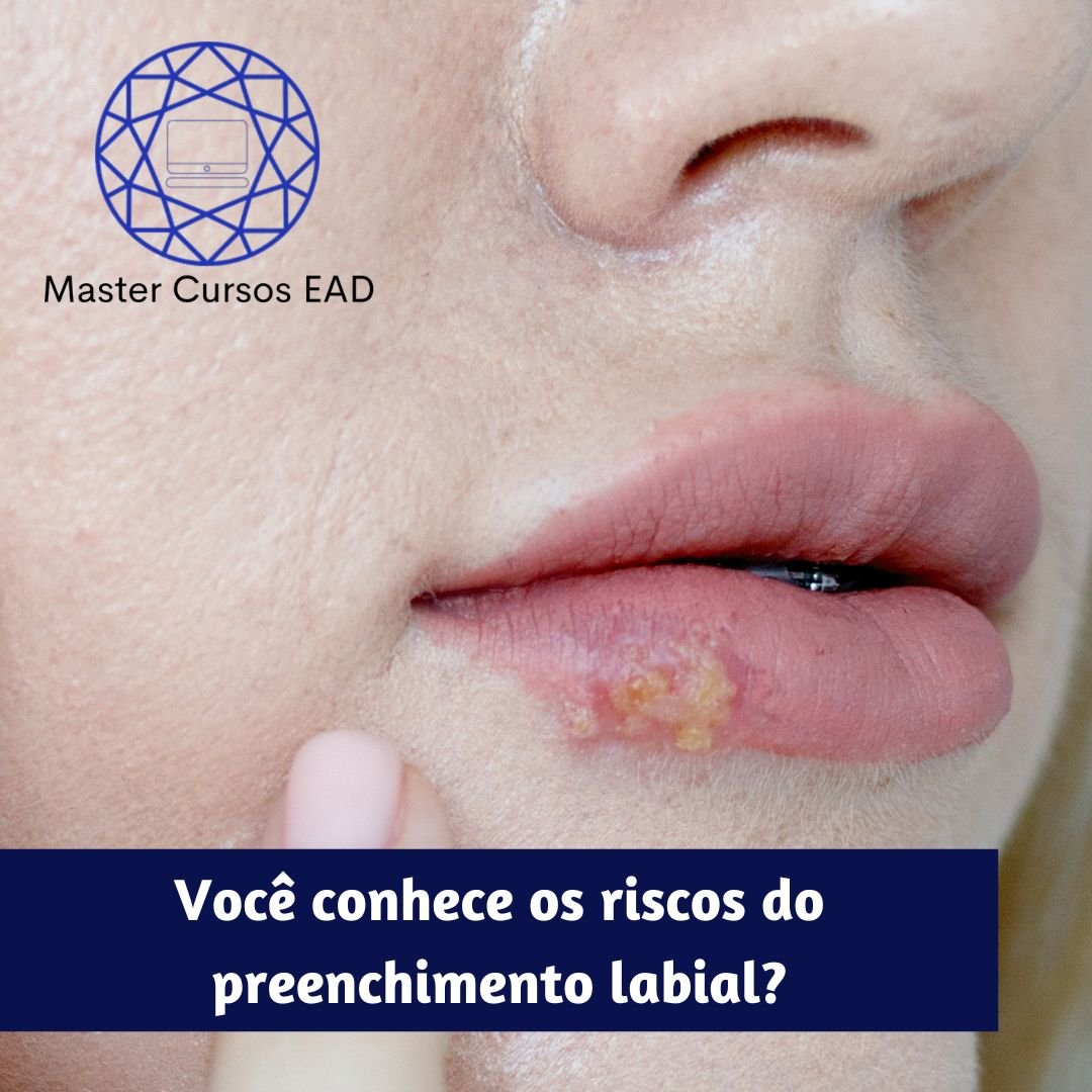 labial Injetáveis em Foco